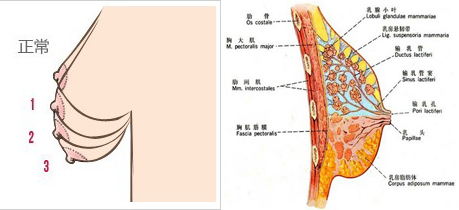 乳房下垂的分型